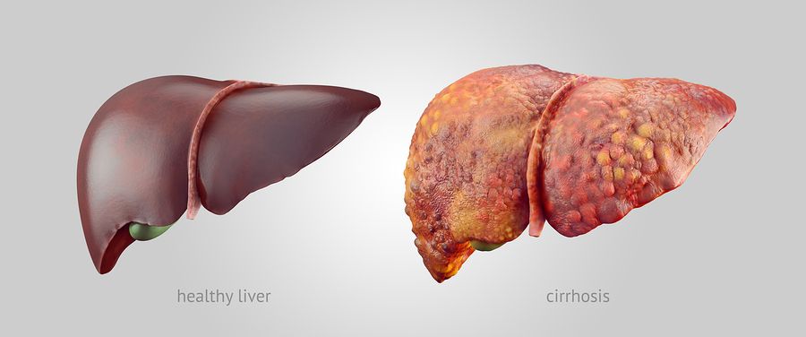 bigstock Realistic Illustration Of Heal 93464381