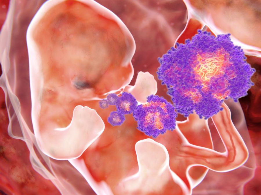 bigstock Zika virus fetus 120450902