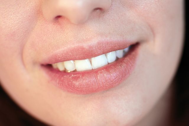 bigstock Girl smiling 9664247