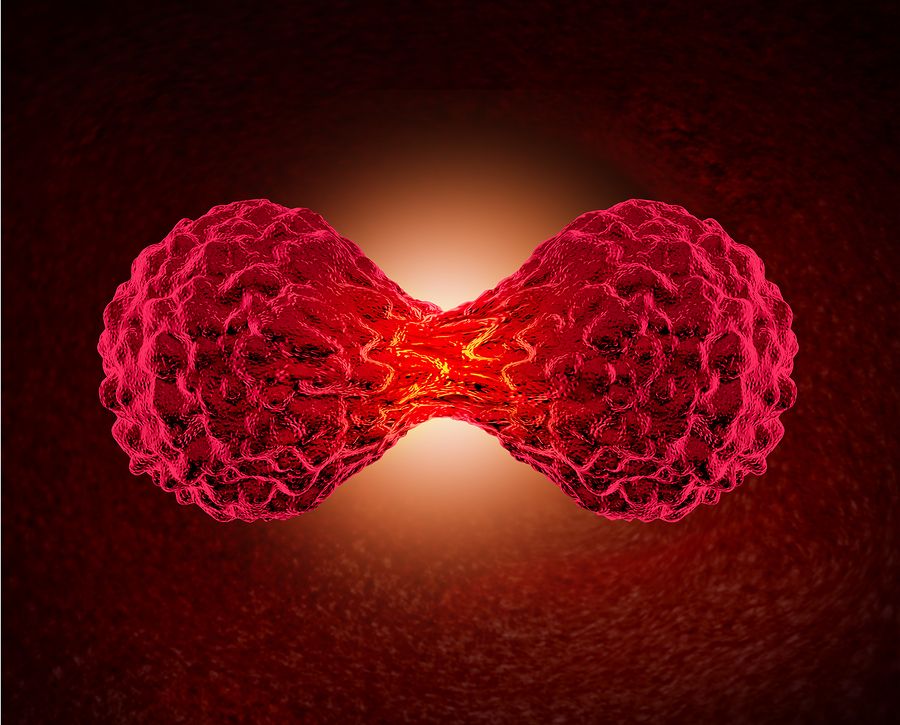 bigstock Cancer Cell Dividing 94076120