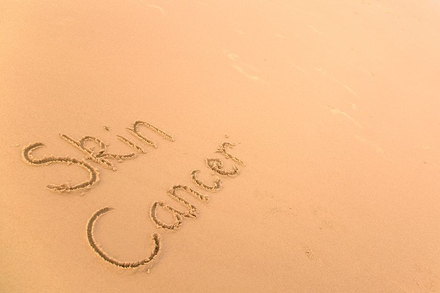 bigstock Skin Cancer In Sand 2664844