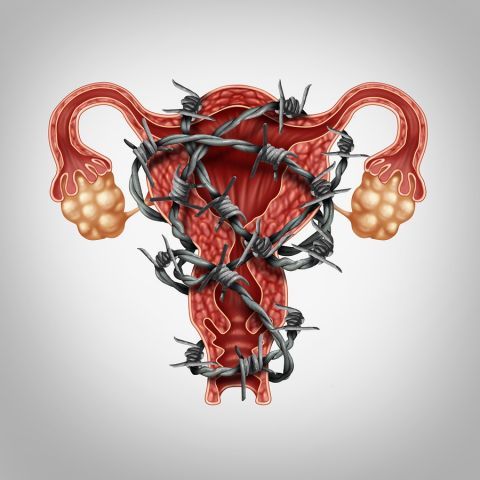 bigstock Uterus Pain 116536817
