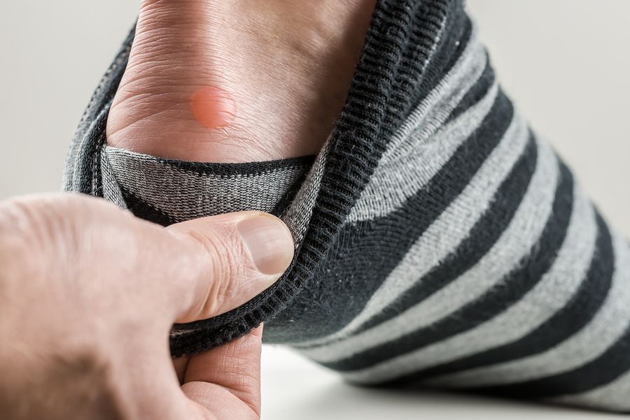 bigstock Man With A Blister On His Heel 61547753