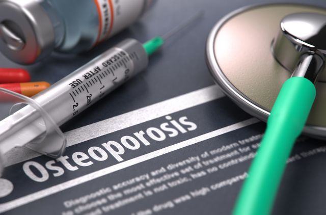 bigstock Diagnosis Osteoporosis Medi 106455626