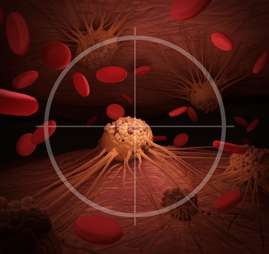 bigstock Targeting Cancer 115485692