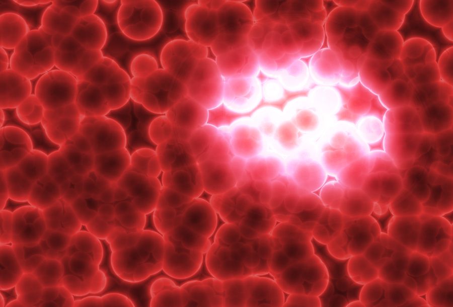 bigstock Growing Tumor 3404598