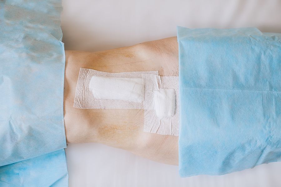 bigstock bandaging the abdomen on the o 110146319