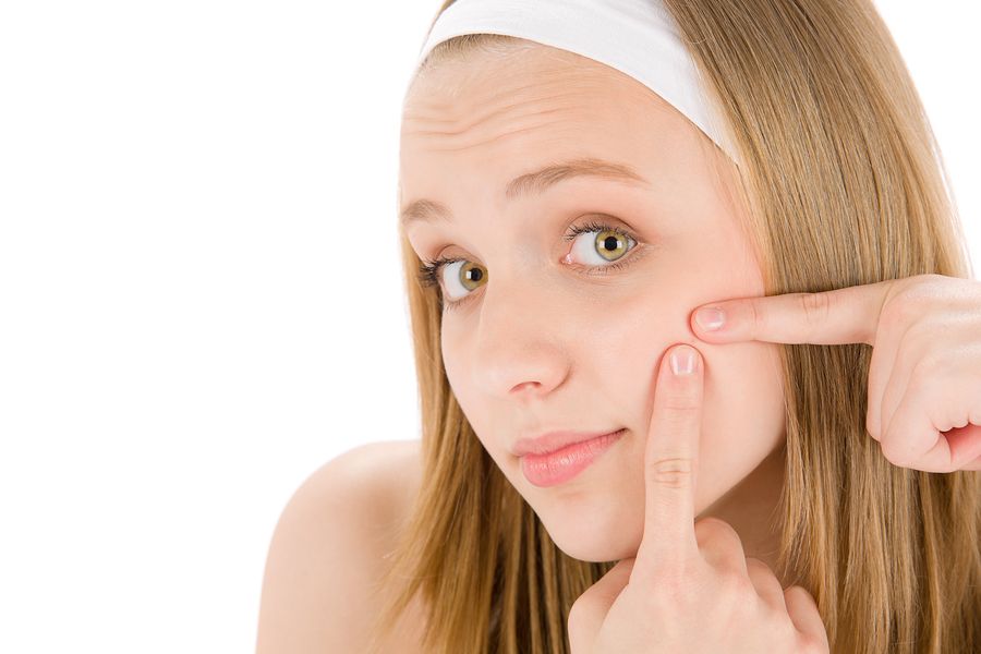 bigstock Acne Facial Care Teenager Woma 18605165