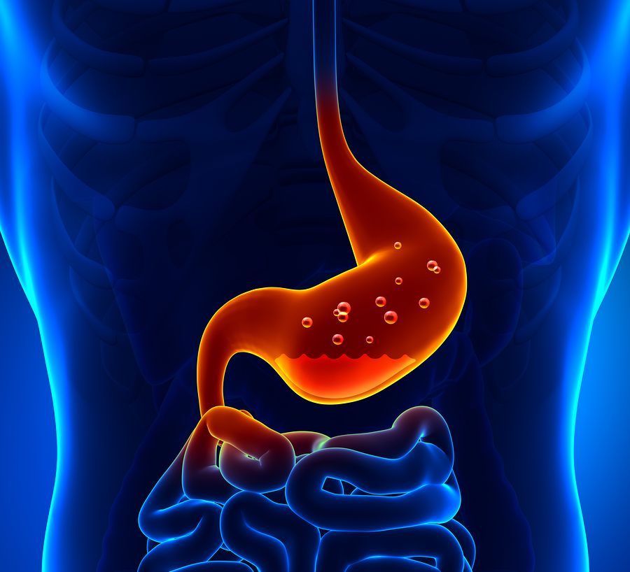 bigstock Gastric Acid 59883629