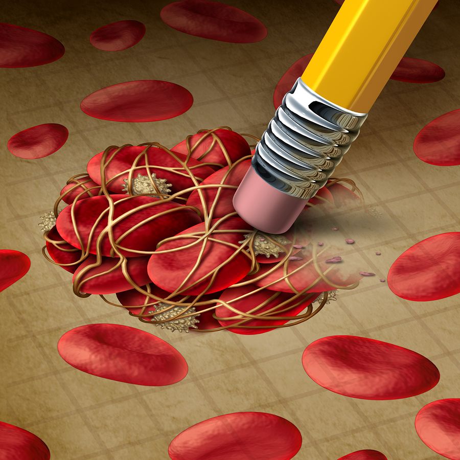 bigstock Blood Clot Treatment 120452591
