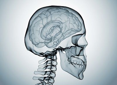 bigstock Brain X Ray 20100836