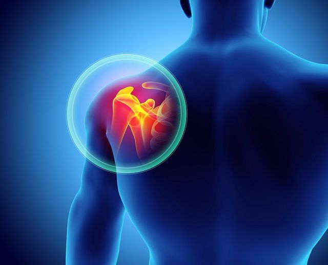 bigstock Shoulder Painful Skeleton X ra 143605157