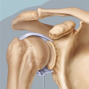 rotator cuff