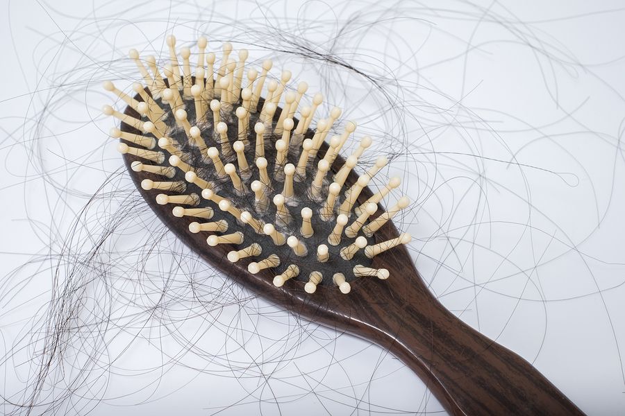 bigstock Hair Loss Problem On Bruch On 98343899