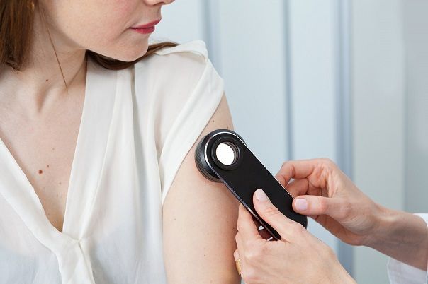 bigstock Dermatologist examining birthm 138497462