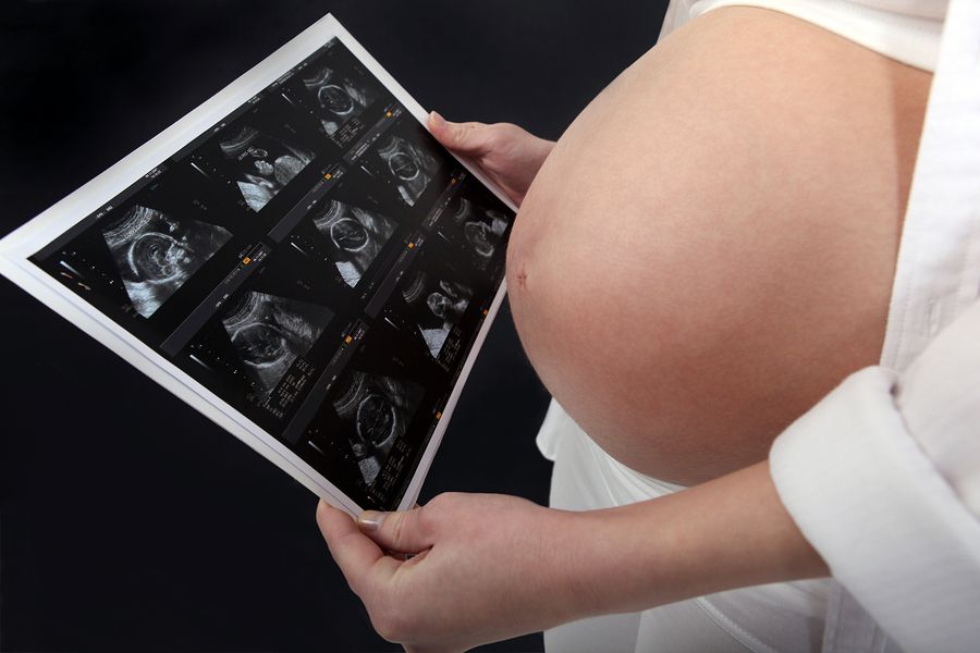 bigstock Pregnant woman looking at ultr 39709264