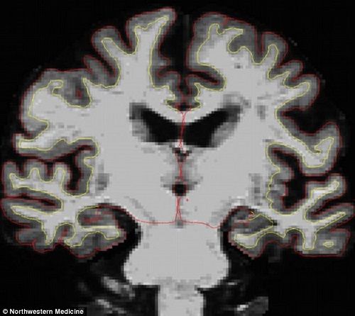 3EEF883A00000578 4379438 image a 10 1491332099655