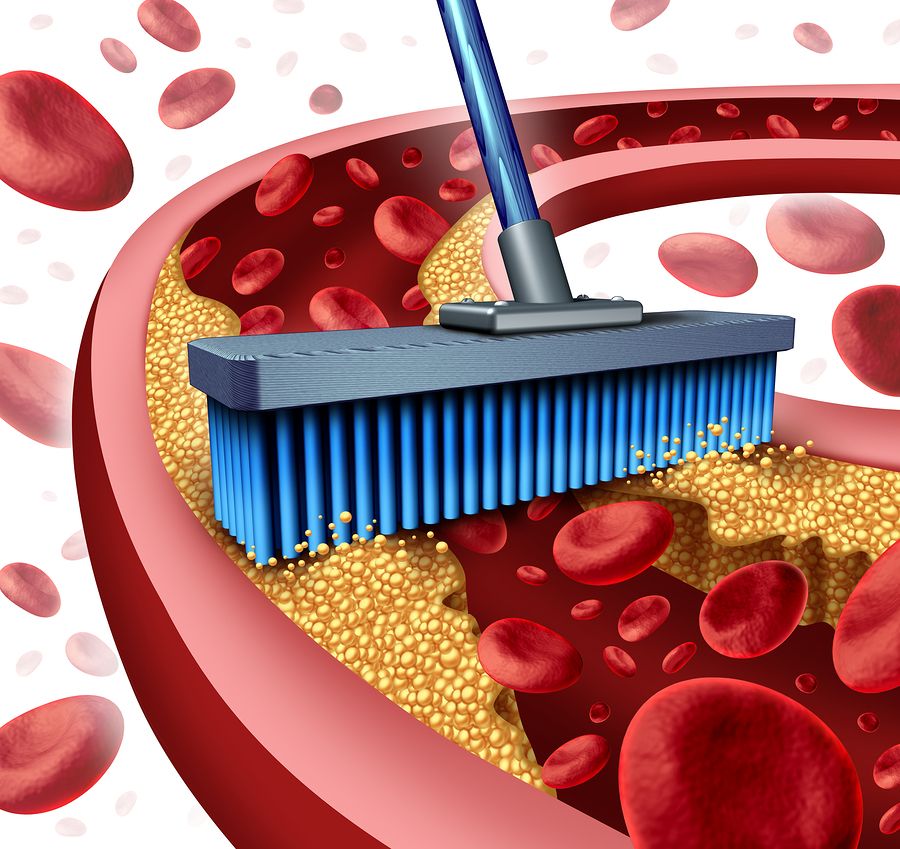 bigstock Cleaning Arteries 64206640