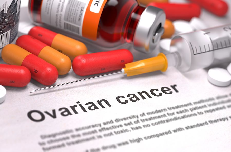 bigstock Ovarian Cancer Diagnosis Medi 89108942