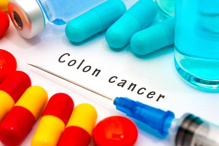 bigstock Colon Cancer 109968236