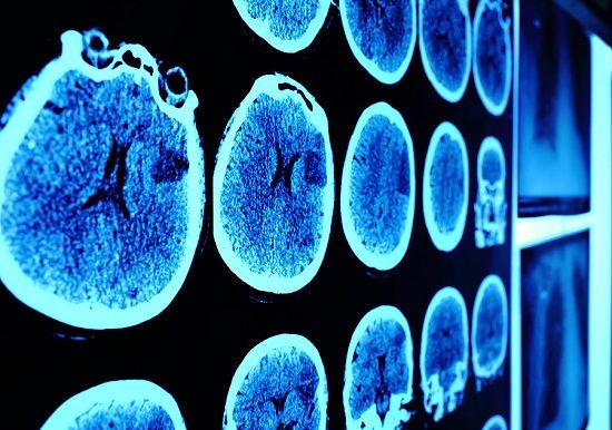 bigstock Skull Ct Scan Picture On The W 106578347