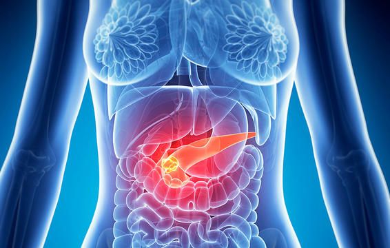 karkinos pancreas