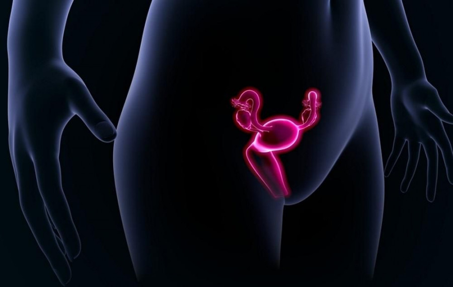 ovarian cancer