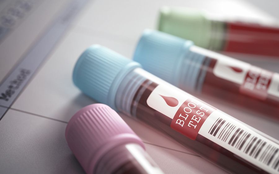 blood test