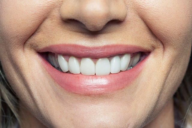01 diseases teeth smile