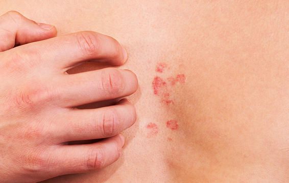 1 signs food allergy skin