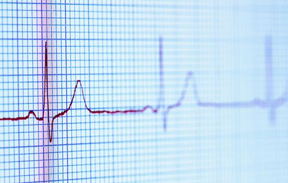 2 signs food allergy weak pulse