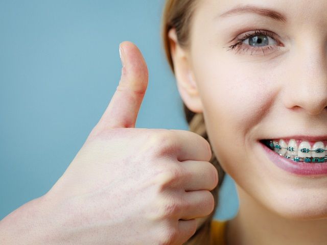 bigstock Young Woman Showing Teeth Brac 195142123