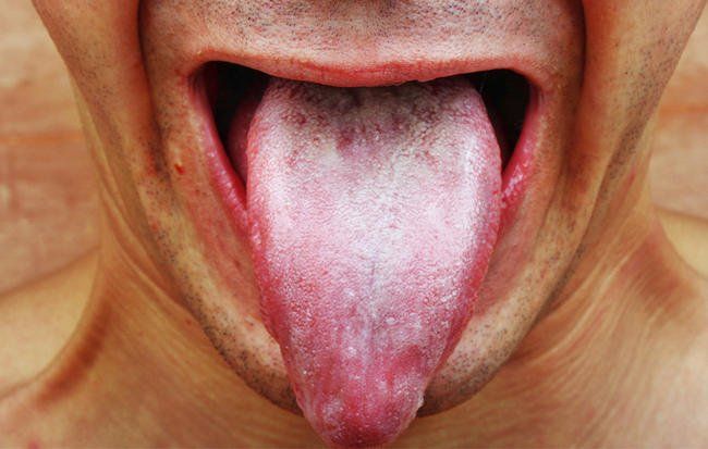 white film on tongue