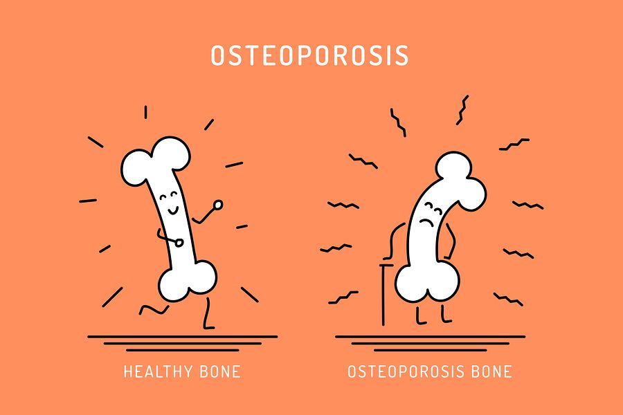 osteoporosis