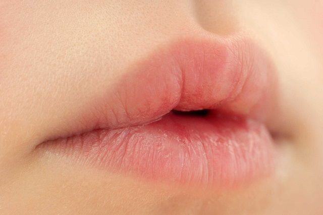 05 Little Body Changes that Reveal a Lot About Your Health chapped 172911615 gacooksey