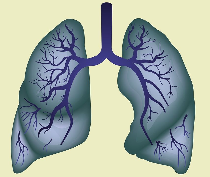pneumonia