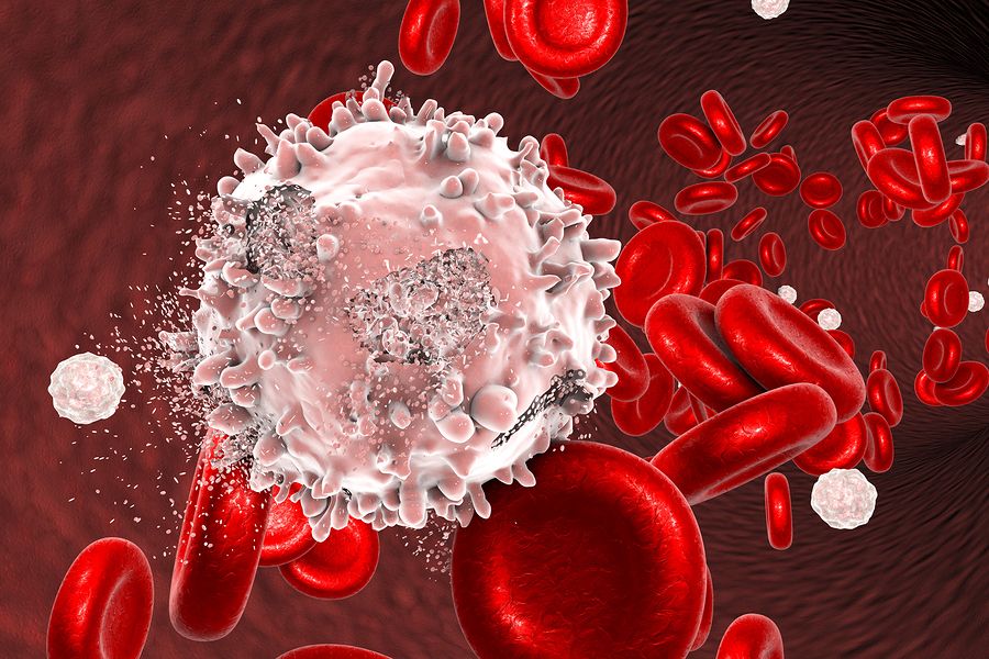 blood cancer