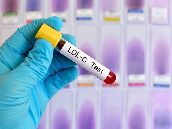 ldl