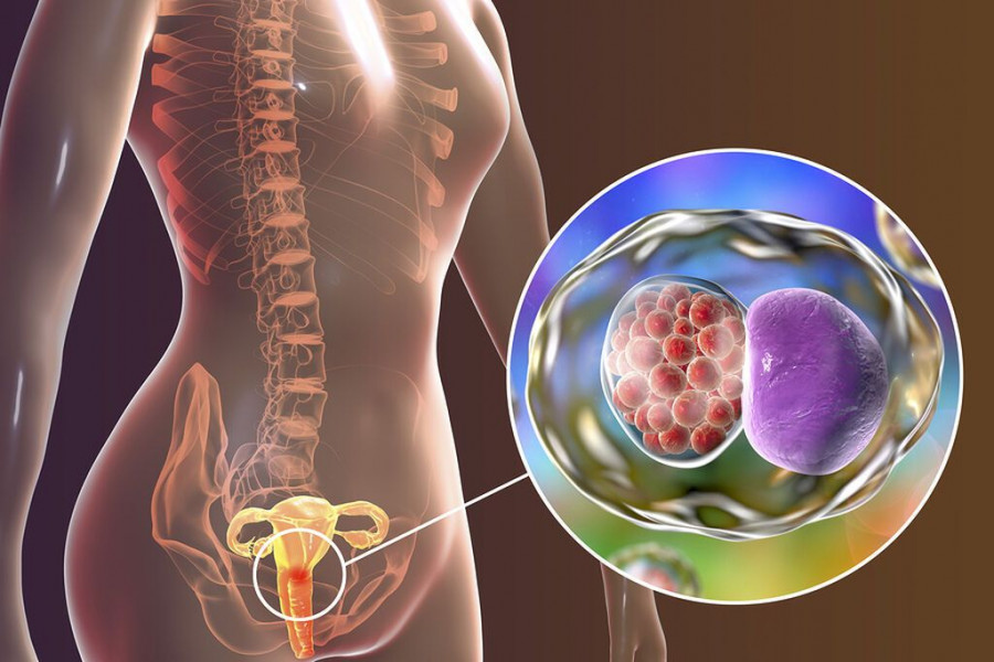 1643645246875-219679884-xlamidia.jpg