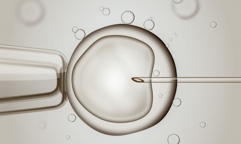 ipovoithoumeni anaparagogi