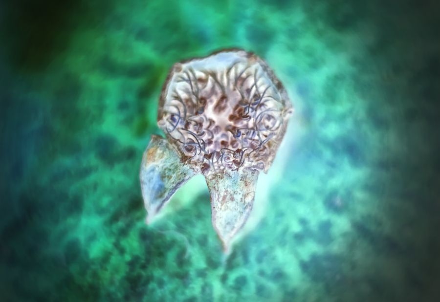 bigstock Mammary Cancer Cancer Cells U 286275220