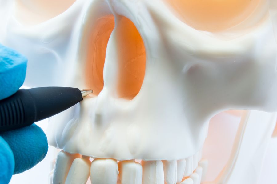 bigstock Doctor Showing Patient Bone An 285052816