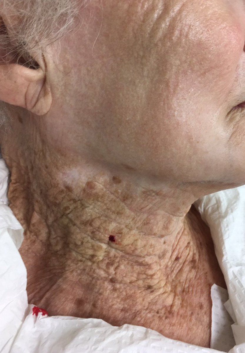 epidermida-giransi.jpg